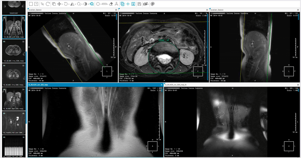 Inobitec DICOM Viewer Pro 2.15.0 Cracked